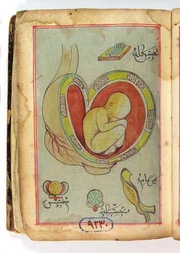 L0033314 Figure of a baby in a womb. Turkish Ottoman Manuscript Credit: Wellcome Library, London. Wellcome Images